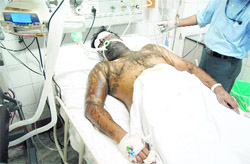 Victim Sumit recuperates at the DMCH in Ludhiana.