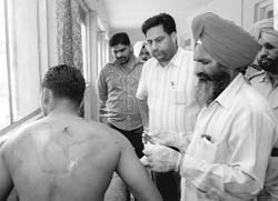 Injured Revinder Singh Neetu, who was shot at by unknown persons at the Rajpura 