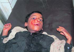 A boy who was injured in a leopard attack in Dehradun in July