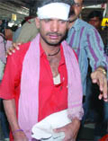  An injured coolie is taken to hospital