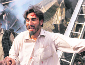 An injured person at the site of the explosion in Peshawar on Wednesday.