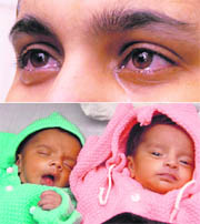 The twin sisters at the Sector 16 Government Multi-Specialty Hospital and their mother with tears in her eyes after the recovery of her daughters.