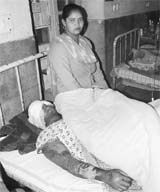 Paramjit Kaur, who was attacked with acid, at a hospital in Patiala on Friday.