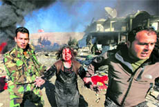 A victim is taken away from the site of a bomb blast in Kabul on Tuesday.  Reuters