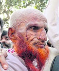 A Gujjar Congress worker with injuries he suffered in a lathi charge by the police in Dehradun on Monday.
