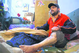 Som Raj shows his injured leg at his rented house in Jammu.