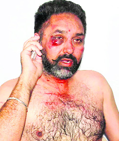 Tehsildar Maj GS Benipal (retd), who was stripped and assaulted in his office.