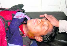 Victim Lokendra Kumar at the Doon Hospital in Dehradun