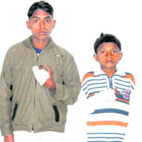 The minor children whose fingers were severed while working in industries in Ludhiana.