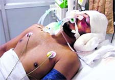 The victim, Prabhdeep Singh, recuperates at the DMCH in Ludhiana on Wednesday