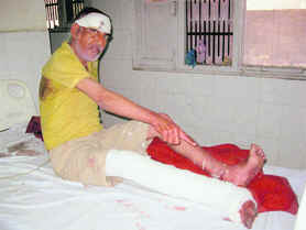 Sham Lal shows his injuries in the General Hospital, Sirsa, on Saturday.