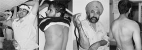 The injured being treated at Civil Hospital, Dera Bassi