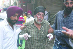 An injured man comes out of hospital at Karol Bagh in New Delhi on Tuesday.