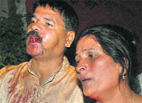 The injured at the police station in Industrial Area, Phase I, Chandigarh, on Tuesday.