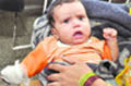 A child who lost his thumb due to the alleged negligence of the staff at Doon Hospital.