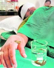 A patient undergoing treatment with leeches in Mandi Gobindgarh