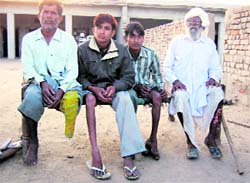 Members of a family at Teja Rawela village, who are suffering from various diseases due to the use of the contaminated waters of the Sutlej. A Tribune photograph