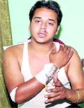 Jeewanjot Singh shows his injuries at his house in Gidderbaha on Saturday. Tribune photo: Pawan Sharma