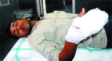 Onkar, who was injured in a mobile blast, in a hospital in Amritsar on Sunday.