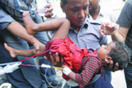 A girl injured in the stampede being taken to the 