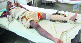 15 Dantewada victims battle for life