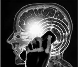 There is nothing in this study showing that using mobile phones can lead to brain tumours