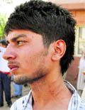Vineet Malhotra with injury marks on his neck