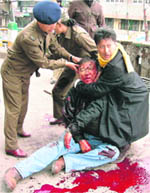 President of the Akhil Bharatiya Gorkha League, Madan Tamang, being assisted by cops and a supporter after he was repeatedly stabbed with swords in Darjeeling