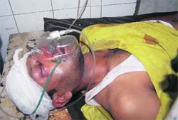 Sanjay who was allegedly attacked at the Prince Chowk under treatment at the Doon Hospital on Tuesday