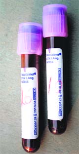Outdated vacutainers being used by the PGIMS, Rohtak.