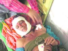 A woman injured in a leopard attack in Pitthoragarh district on Monday.