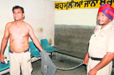 Deepak Kumar, who accused the police of torturing him, shows his injuries at the Civil Hospital, Bathinda,