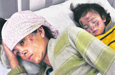 A mother with her injured child being treated at Army hospital.