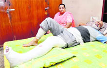 Traffic marshal Gurnam Singh at his Sector 10 residence after he fractured his leg in a road accident at Sector 45, Chandigarh, on Saturday.