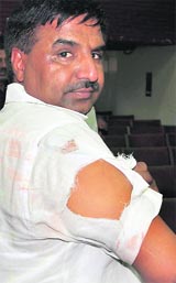 Kurukshetra District Congress president Jai Bhagwan Sharma shows his injuries.