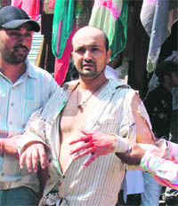 The victim shows his injuries in Ludhiana on Thursday.