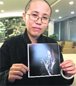Liu Xia, wife of Chinese Liu Xiaobo, holds her photo during an interview in Beijing.