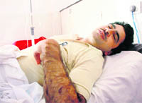 A GMC employee who was hospitalised after being beaten up by his colleague on the GMC premises in Jammu
