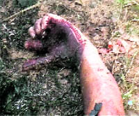 The hand (coloured with heena) of the victim.