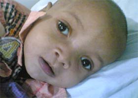The infant is undergoing treatment at the hospital in New Delhi