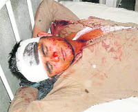 Injured polytechnic student Sudesh Kumar in a Sirsa hospital.