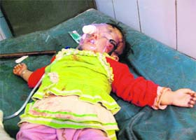 An injured child under treatment at a hospital