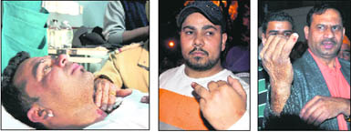 The injured in the Friday night incident outside the residence of Punjab Assembly Deputy Speaker Satpal Gosain.