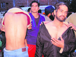 Inmates rescued from an illegal de-addiction centre in Amritsar on Saturday show scars on their bodies at the Civil Hospital