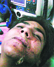 In this photograph released by police, Ajmal Kasab is seen lying at an undisclosed location in Mumbai.