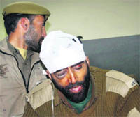 An injured police constable at the SKIMS Hospital in Srinagar on Monday. 