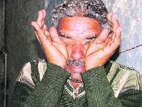 Satpal Gaba, father of the deceased boy, breaks down