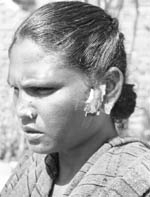 Kiran Bala who sustained injuries after being attacked by a wild animal in the field.
