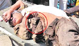 An injured passenger being taken to the GMCH in Jammu on Tuesday. (inset) An iron rod piercing through his abdomen