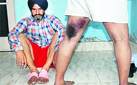 Paramjeet Singh and Sukhdev Singh (sitting) show injuries allegedly inflicted by the police, in Bathinda on Tuesday.